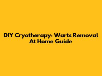 DIY Cryotherapy: Warts Removal At Home Guide