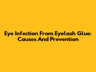 Eye Infection From Eyelash Glue: Causes And Prevention