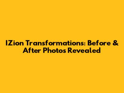 IZion Transformations: Before & After Photos Revealed