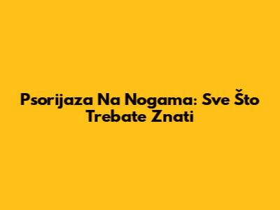 Psorijaza Na Nogama: Sve Što Trebate Znati