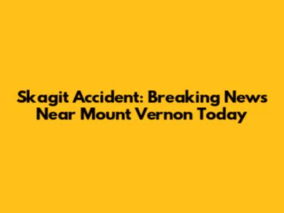 Skagit Accident: Breaking News Near Mount Vernon Today