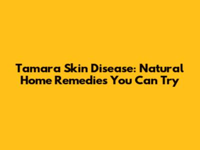 Tamara Skin Disease: Natural Home Remedies You Can Try
