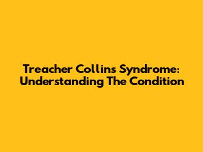 Treacher Collins Syndrome: Understanding The Condition