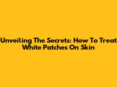 Unveiling The Secrets: How To Treat White Patches On Skin