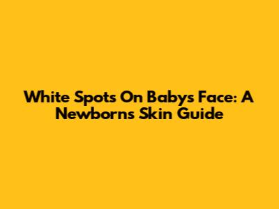 White Spots On Baby's Face: A Newborn's Skin Guide